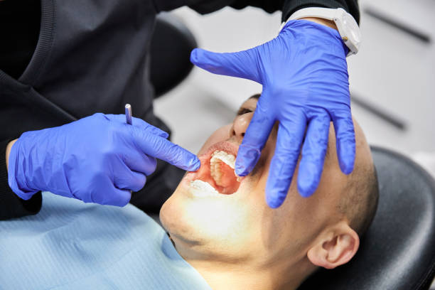 Best Broken or Chipped Tooth Repair in Bangs, TX